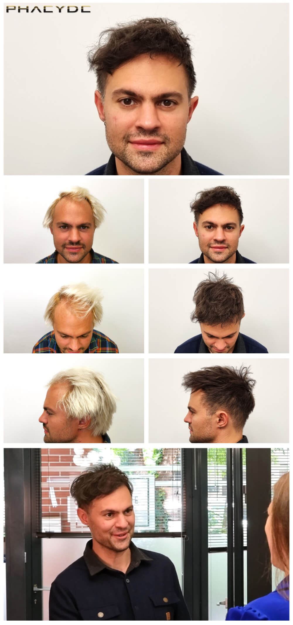 Máté – 2200+ Grafts